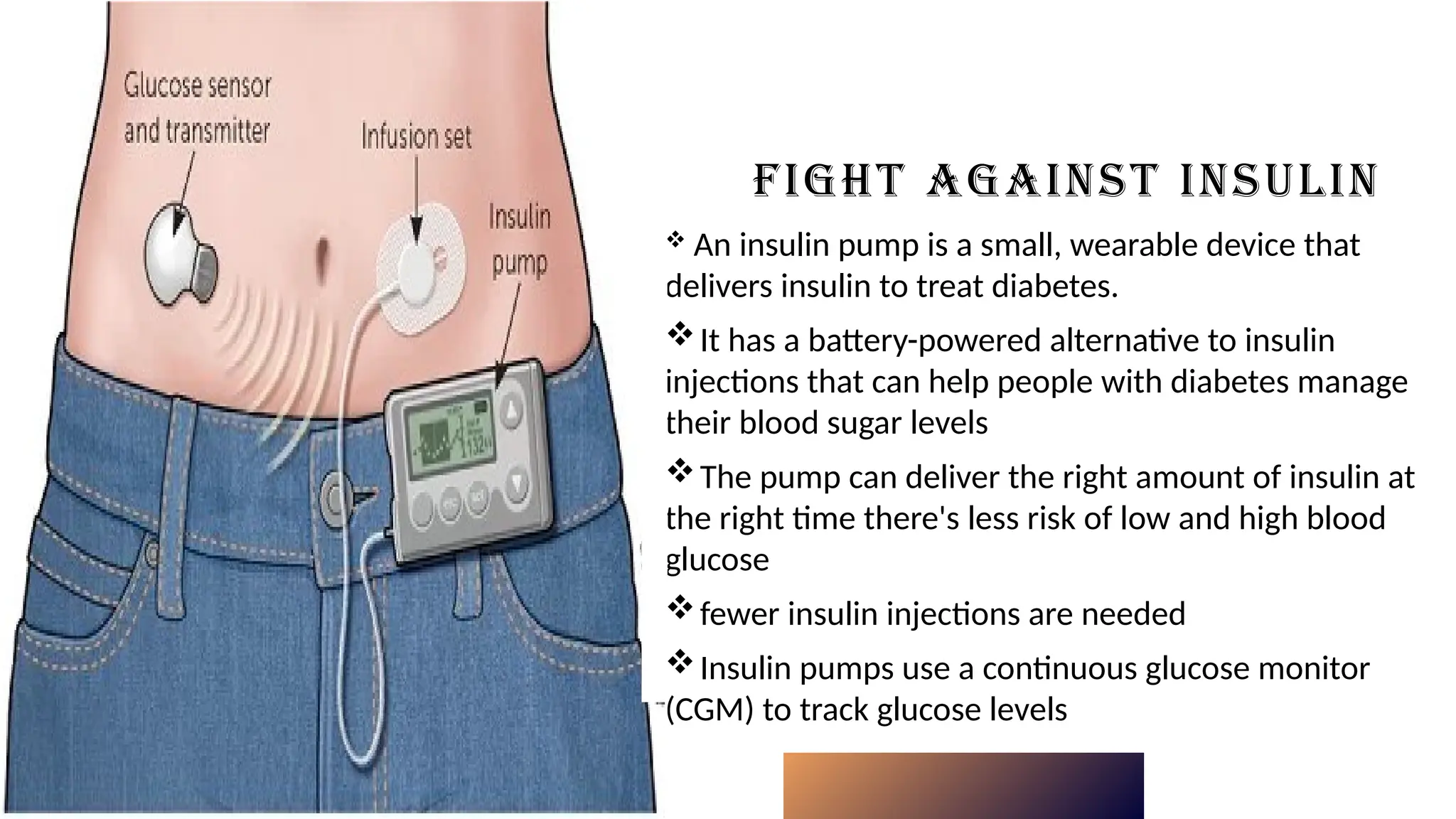 FIGHT AGAINST INSULIN
 An insulin pump is a small, wearable device that
delivers insulin to treat diabetes.
It has a battery-powered alternative to insulin
injections that can help people with diabetes manage
their blood sugar levels
The pump can deliver the right amount of insulin at
the right time there's less risk of low and high blood
glucose
fewer insulin injections are needed
Insulin pumps use a continuous glucose monitor
(CGM) to track glucose levels
Click icon to add picture
 