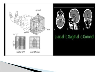 Basic principle and hardwares of ct scan.pptx