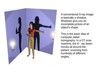 A conventional X-ray image
is basically a shadow.
Shadows give you an
incomplete picture of an
object's shape.
This is the basic idea of
computer aided
tomography. In a CT scan
machine, the X- ray beam
moves all around the
patient, scanning from
hundreds of different
angles.
 