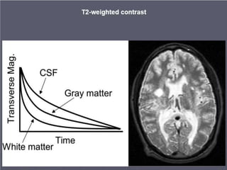 Mri Math BASIC PRINCIPLE OF MRI.pptx