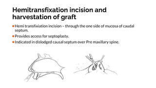 Transfixation Incision Basic principle of rhinoplasty. by venukumar.t | PPTX