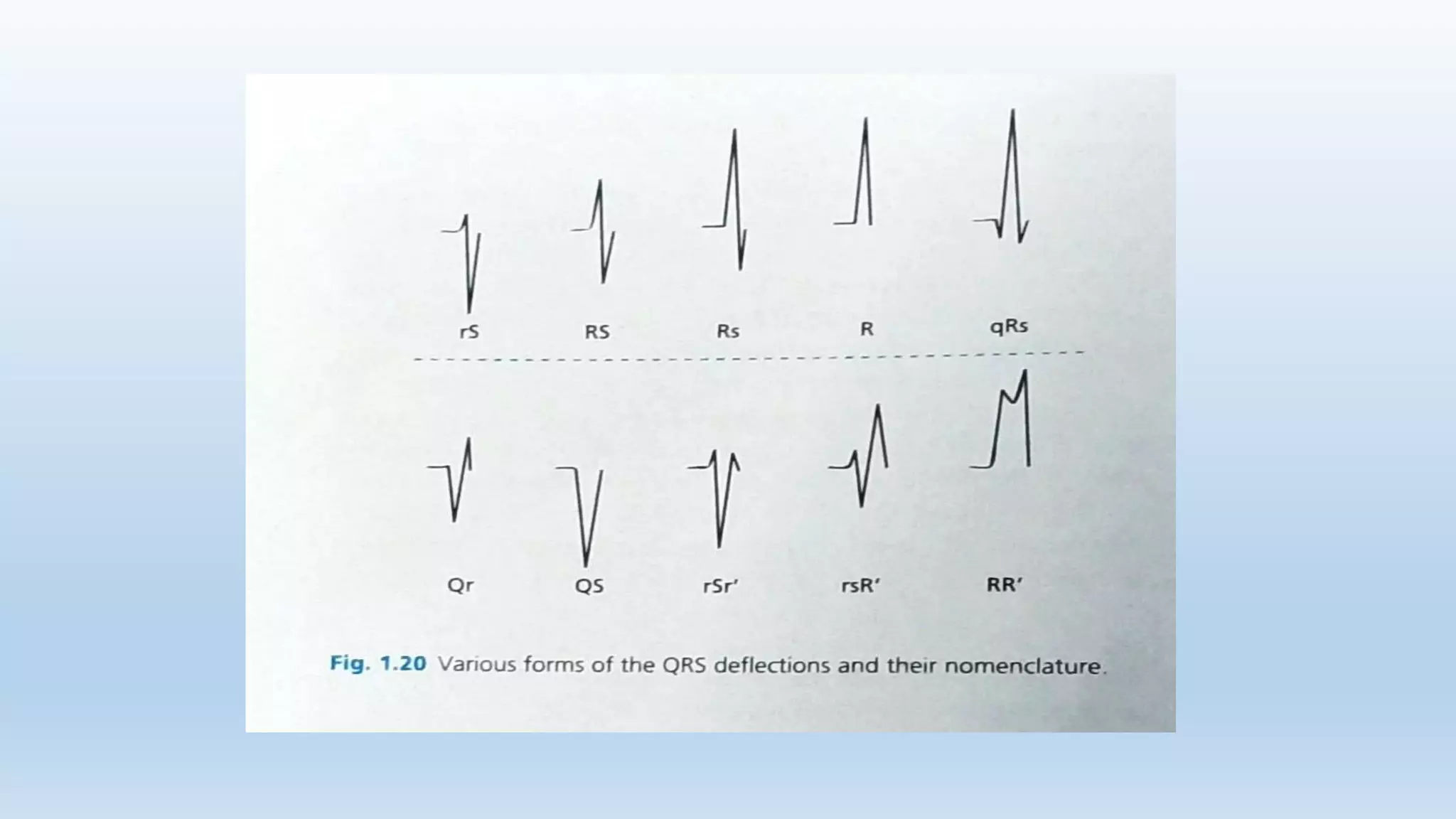 BASICS OF ECG pptx.pptx
