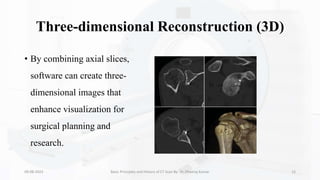 Three-dimensional Reconstruction (3D)
• By combining axial slices,
software can create three-
dimensional images that
enhance visualization for
surgical planning and
research.
09-08-2023 Basic Principles and History of CT Scan By- Dr. Dheeraj Kumar 15
 
