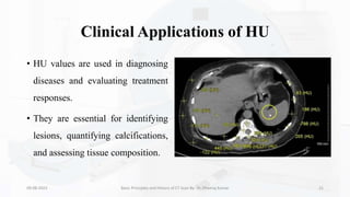 Clinical Applications of HU
• HU values are used in diagnosing
diseases and evaluating treatment
responses.
• They are essential for identifying
lesions, quantifying calcifications,
and assessing tissue composition.
09-08-2023 Basic Principles and History of CT Scan By- Dr. Dheeraj Kumar 21
 