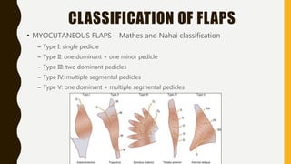Pedicle Flaps Example Basic principles and techniques of microsurgery - Dr. Sachin. M. | PPTX