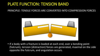 Basic principles internal fixation | PDF
