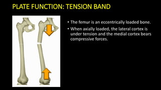 Basic principles internal fixation | PDF