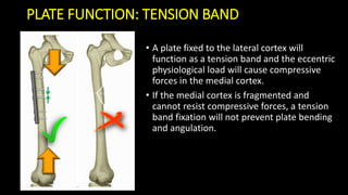Basic principles internal fixation | PDF