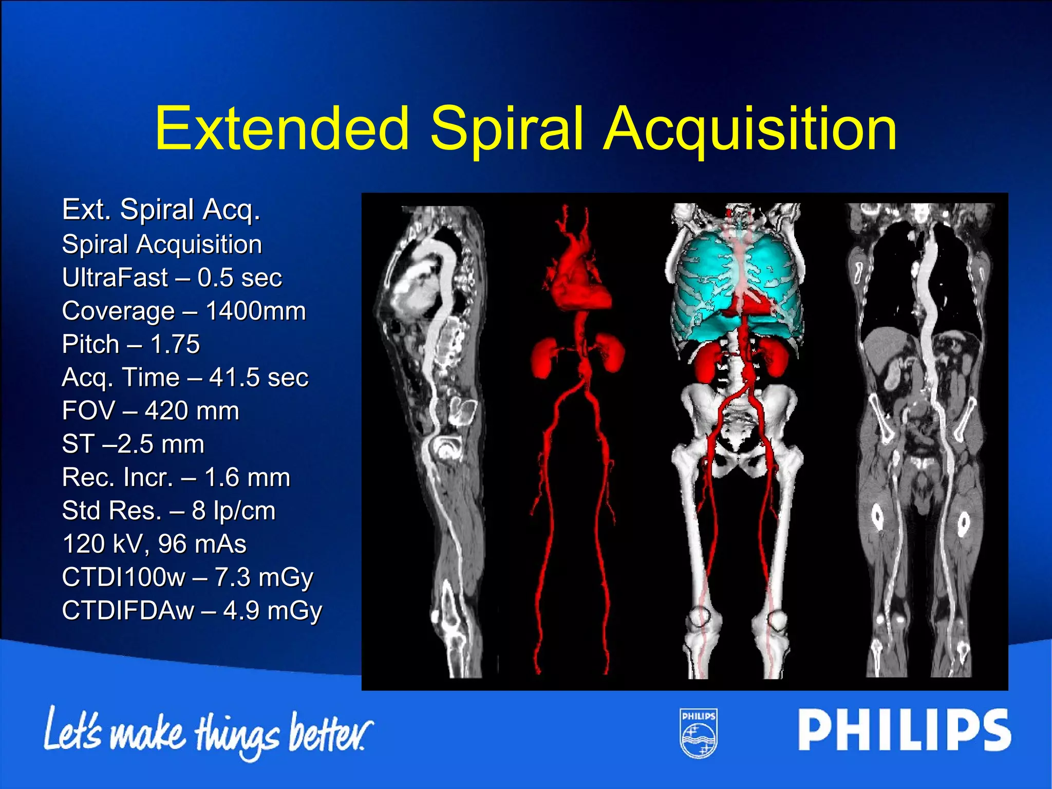 Basic principles of ct scanning | PPT