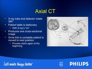 Axial CT
• X-ray tube and detector rotate
360°
• Patient table is stationary
– With X-ray’s “on”
• Produces one cross-sectional
image
• Once this is complete patient is
moved to next position
– Process starts again at the
beginning
 
