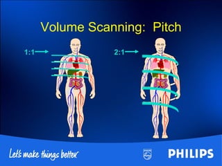Volume Scanning: Pitch
1:1 2:1
 
