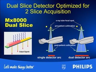 . .
single detector arc dual detector arc
pre-patient collimation
post-patient collimation
x-ray tube focal spot
___
Mx8000
Dual Slice
Dual Slice Detector Optimized for
2 Slice Acquisition
 