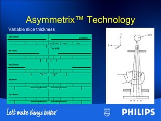 2x0.5mm
4x1mm
4x2.5mm
4x5mm
2x10mm
p-plane
fused fused
to FEE
1mm 1.5mm 2.5mm 5mm
Asymmetrix™ Technology
Variable slice thickness
 