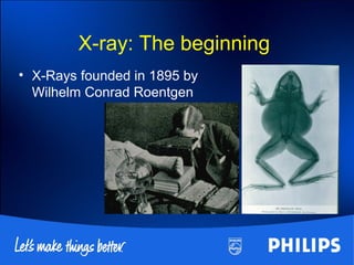 X-ray: The beginning
• X-Rays founded in 1895 by
Wilhelm Conrad Roentgen
 