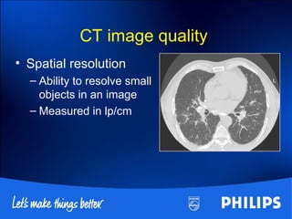 CT image quality
• Spatial resolution
– Ability to resolve small
objects in an image
– Measured in lp/cm
 