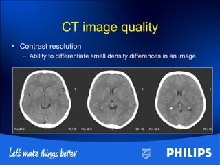 CT image quality
• Contrast resolution
– Ability to differentiate small density differences in an image
 