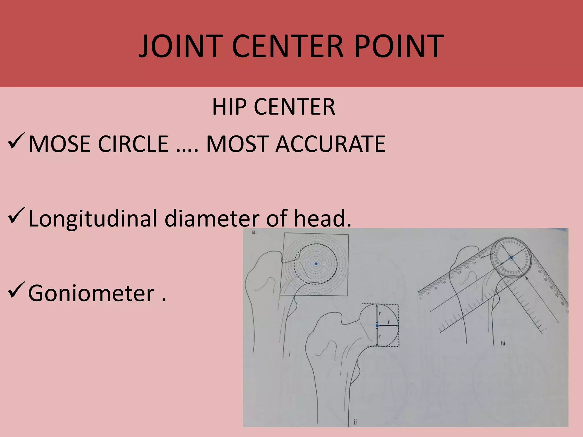 語学・辞書・学習参考書 principles of deformity correction Buy Principles of Deformity Correction Book Online at Low