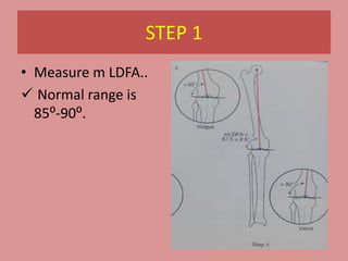 Normal Ldfa Values Basic principles of deformity correction | PPTX