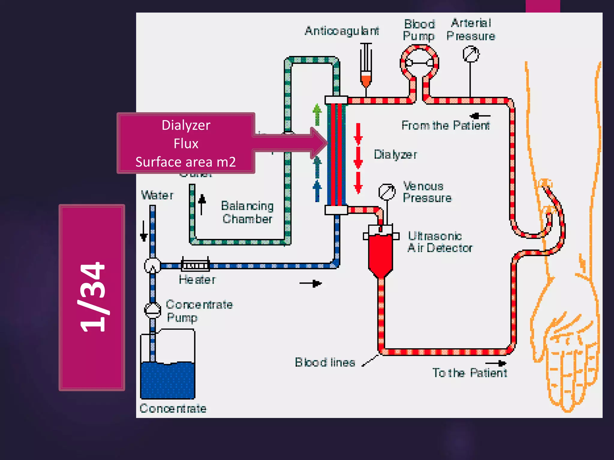 1/34
Dialyzer
Flux
Surface area m2
 