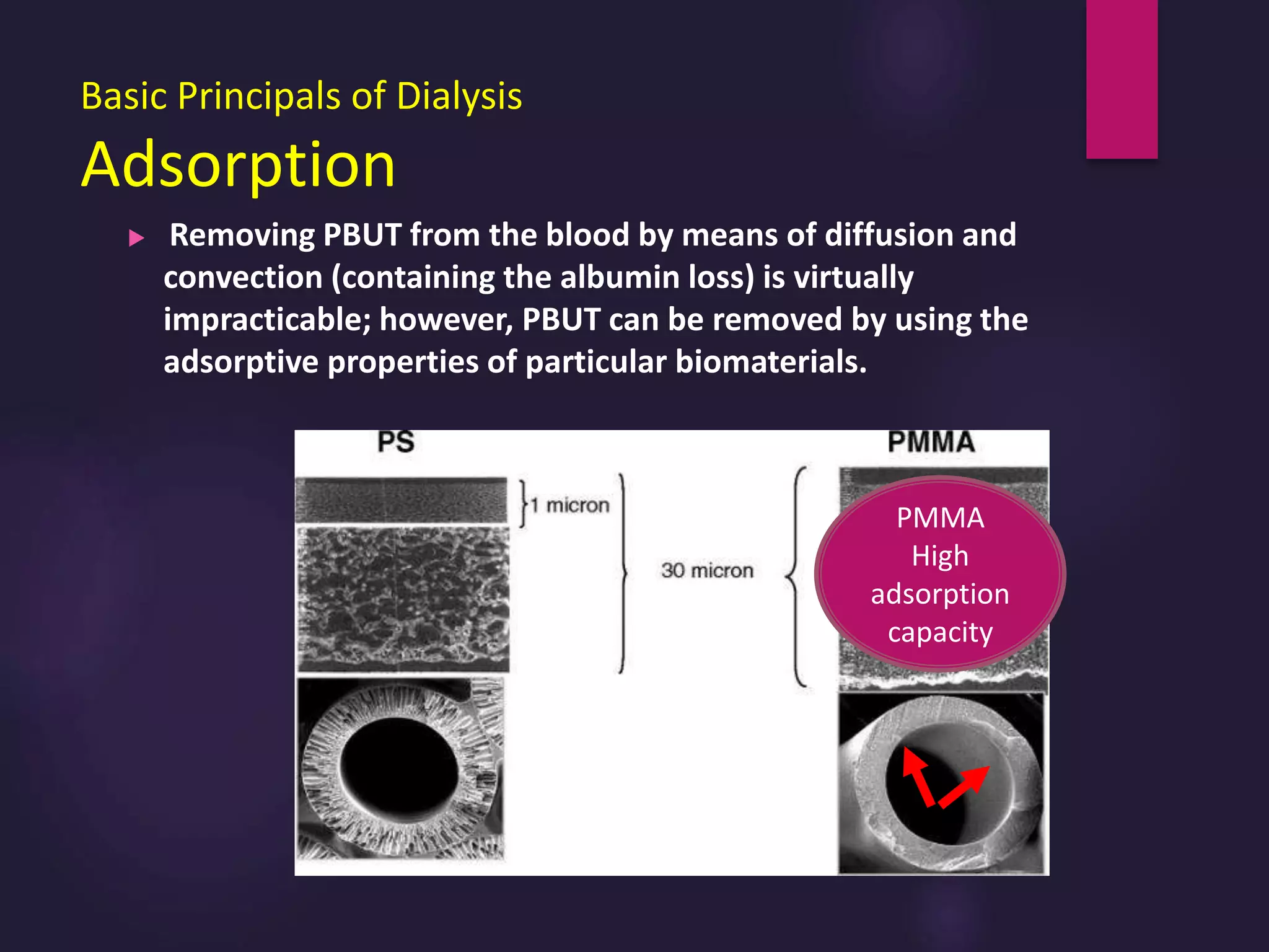Basic Principals of Dialysis
Adsorption
 Removing PBUT from the blood by means of diffusion and
convection (containing the albumin loss) is virtually
impracticable; however, PBUT can be removed by using the
adsorptive properties of particular biomaterials.
PMMA
High
adsorption
capacity
 