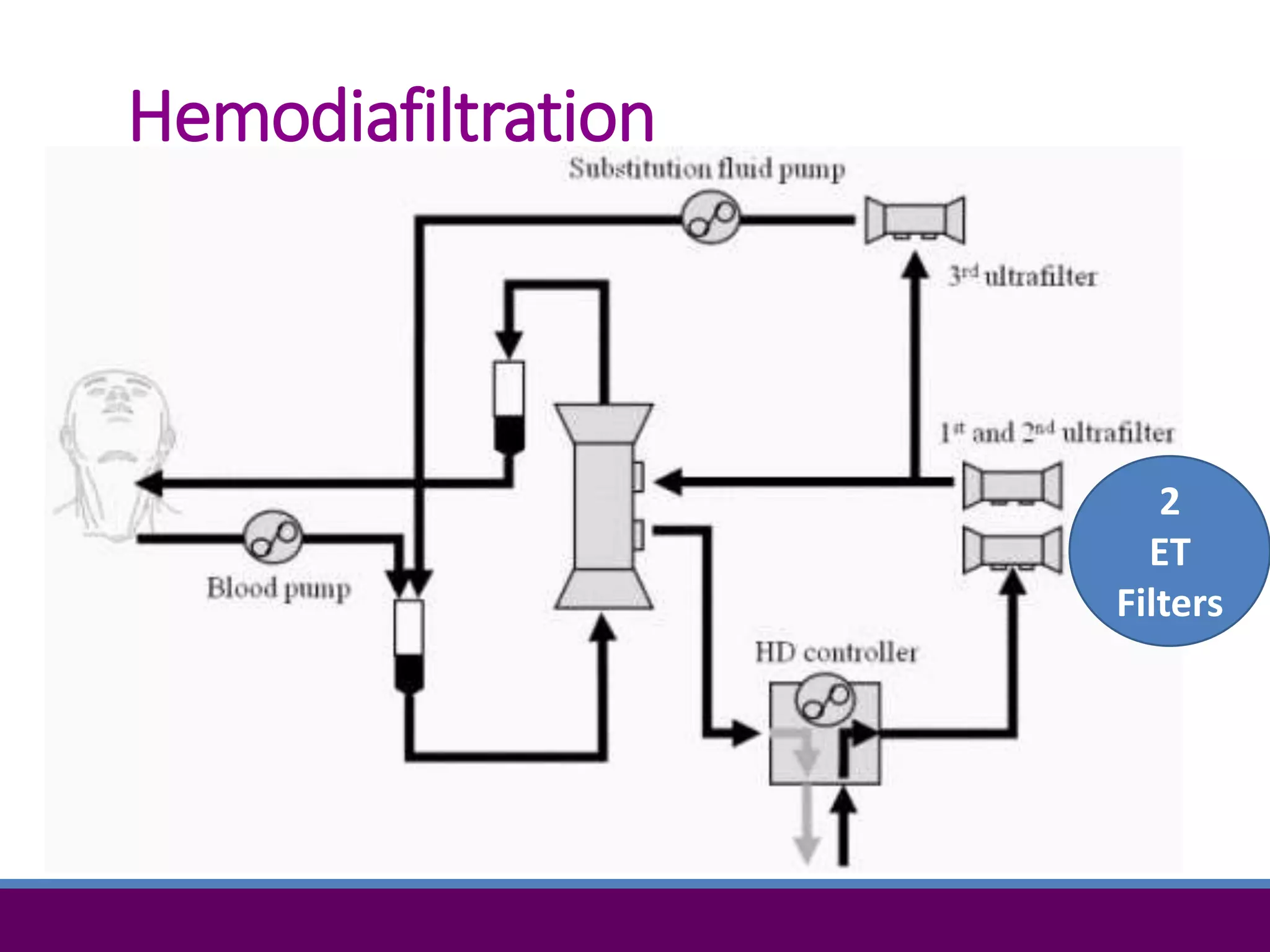 Hemodiafiltration
2
ET
Filters
 