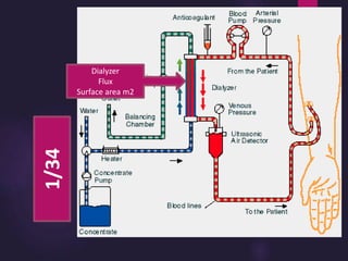 1/34
Dialyzer
Flux
Surface area m2
 