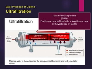 Basic Principals of Dialysis
Ultrafiltration
Transmembrane pressure
(TMP) =
Positive pressure in Blood side + Negative pressure
in Dialysate side in mmHg
Maximum UF
Higher pressure
Lower UF
Lower pressure
 