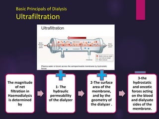 Basic Principals of Dialysis
Ultrafiltration
The magnitude
of net
filtration in
Haemodialysis
is determined
by
1- The
hydraulic
permeability
of the dialyzer
2-The surface
area of the
membrane,
and by the
geometry of
the dialyzer .
3-the
hydrostatic
and oncotic
forces acting
on the blood
and dialysate
sides of the
membrane.
 