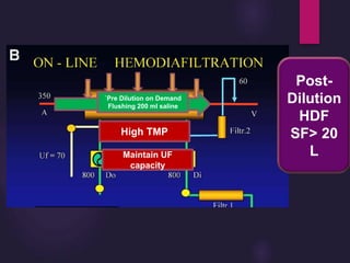 Post-
Dilution
HDF
SF> 20
L
Back filtration
On demand
High TMP
`Pre Dilution on Demand
Flushing 200 ml saline
Maintain UF
capacity
 