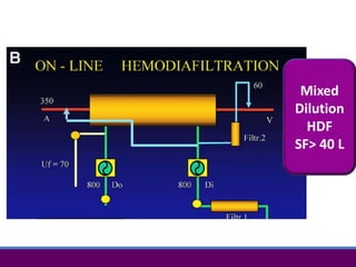 Mixed
Dilution
HDF
SF> 40 L
 