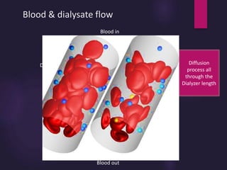 Blood & dialysate flow
Blood in
Blood out
Dialysate out
Dialysate in
Hollow fiber
Casing or jacket
Dialysate
Header
Diffusion
process all
through the
Dialyzer length
Maximumspeed
 