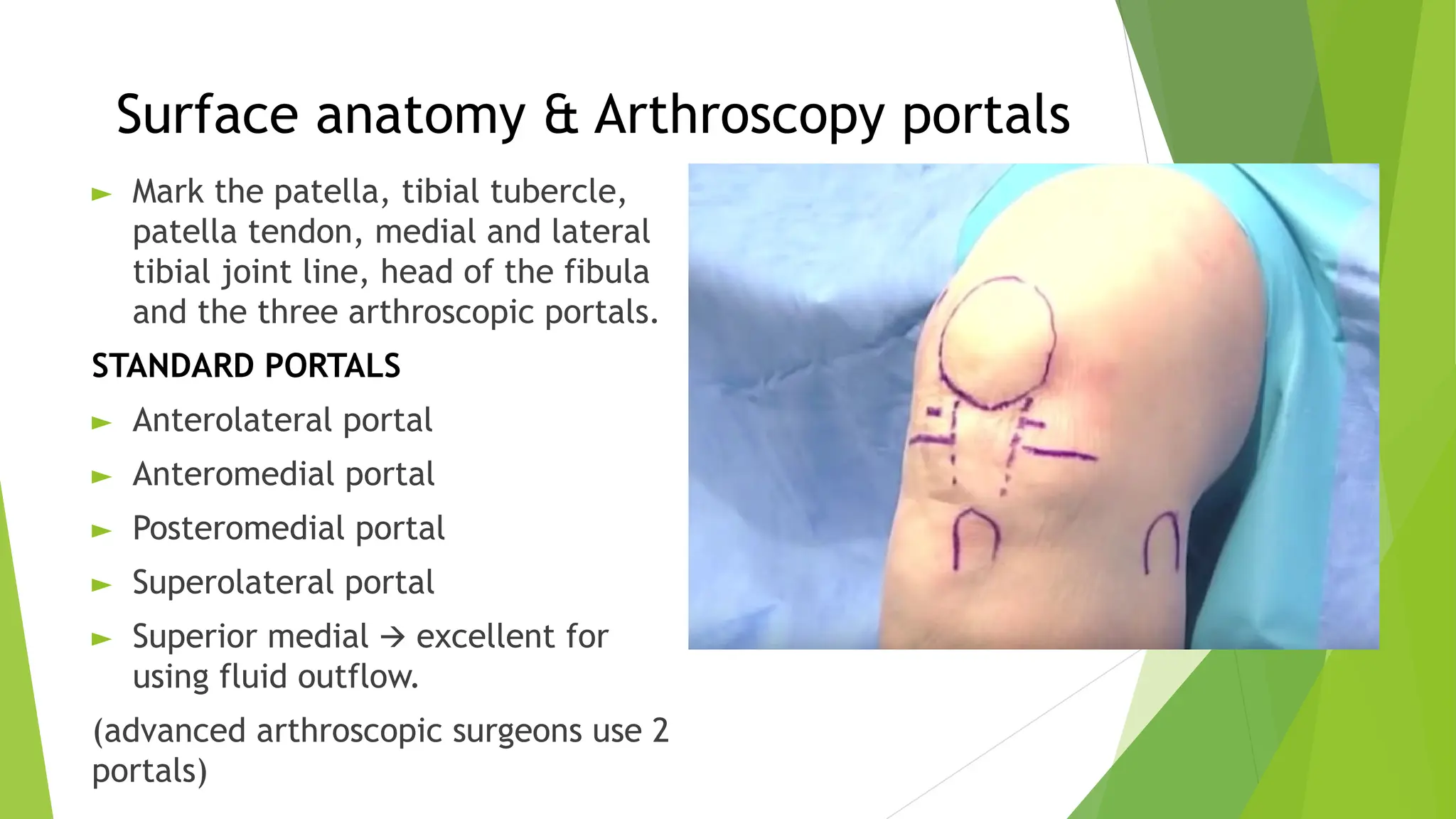 Basic principles of knee arthroscopy Part 2.pptx