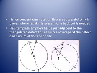 • Hence conventional rotation flap are successful only in
places where lax skin is present or a back cut is needed
• Flap template employs tissue just adjacent to the
triangulated defect thus ensures coverage of the defect
and closure of the donor site

 