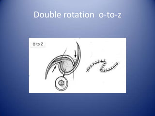 Double rotation o-to-z

 