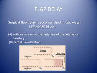 FLAP DELAY
Surgical flap delay is accomplished in two ways:
1.STANDARD DELAY :
(A) with an incision at the periphery of the cutaneous
territory.
(B) partial flap elevation.

 