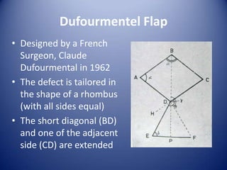 Dufourmentel Flap
• Designed by a French
Surgeon, Claude
Dufourmental in 1962
• The defect is tailored in
the shape of a rhombus
(with all sides equal)
• The short diagonal (BD)
and one of the adjacent
side (CD) are extended

 