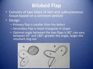Bilobed Flap
• Consists of two lobes of skin and subcutaneous
tissue based on a common pedicle
• Design
– Primary flap is smaller than the defect
– Secondary flap is more triangular in shape
• Optimal angle between the two flaps is 90°, can vary
between 45° and 180°; greater the angle, larger the
resultant dog-ear

 
