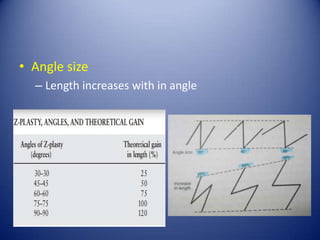 • Angle size
– Length increases with in angle
ANGLE (°)

INCREASE IN
LENGTH (%)

30

25

45

50

60

75

 