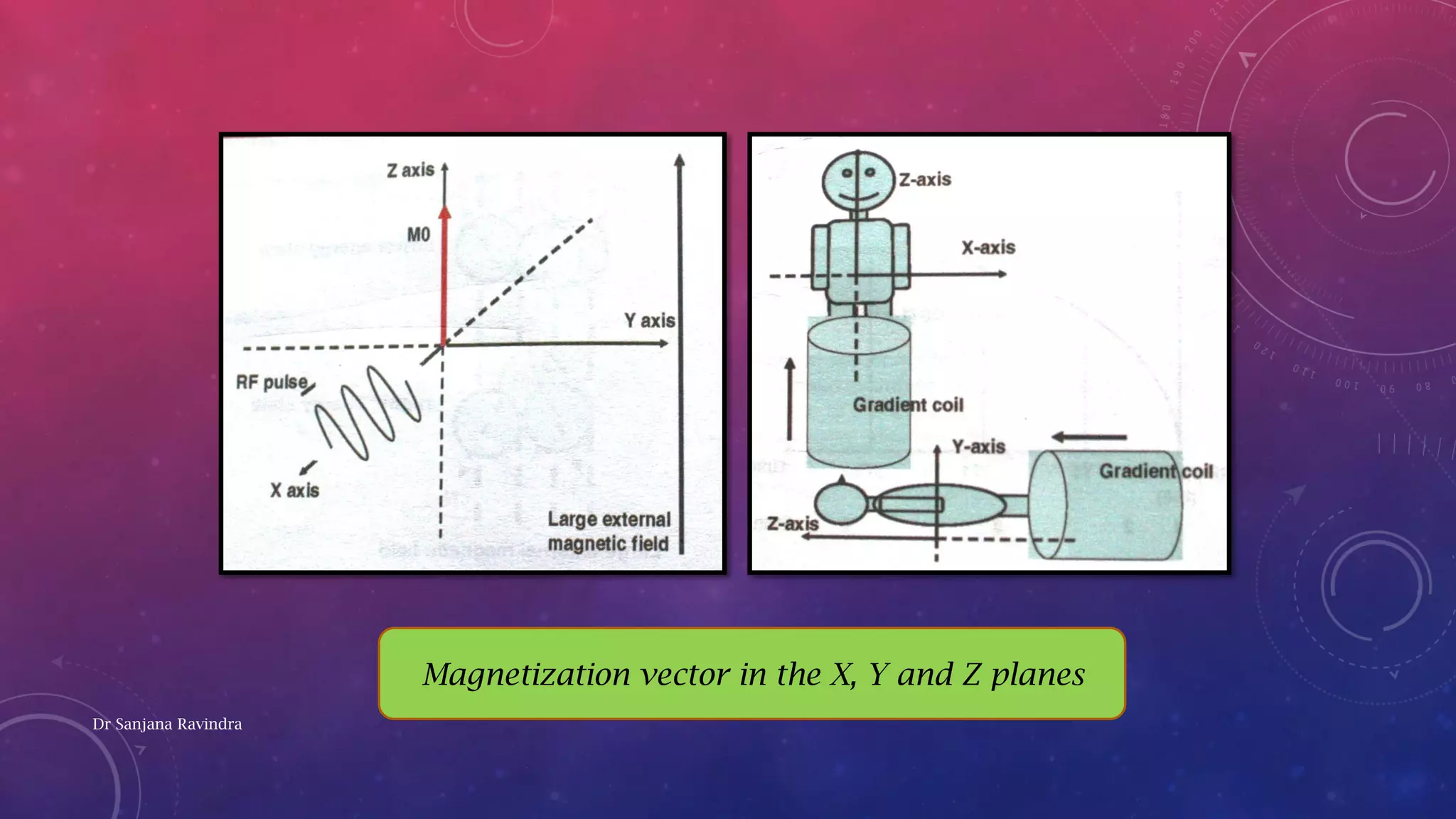 Basic principles of magnetic resonance imaging for beginner - Dr ...