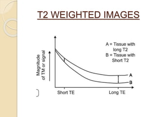 T2 WEIGHTED IMAGES
 