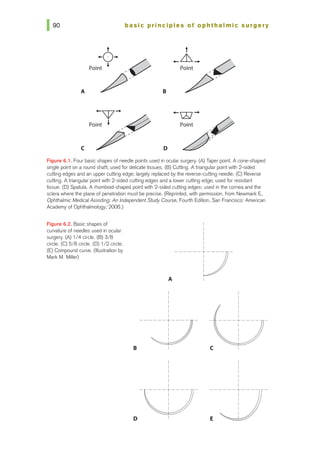 basic principles ot ophthalmic surgery
t t
+0+ ._&_. v
Point • -V pp--
A
p- B
...w.... +-XI-+
Point~ -~
p~~
c
~/ D
Figure 6.1. Four basic shapes of needle points used in ocular surgery. (A) Taper point. A cone-shaped
single point on a round shaft; used for delicate tissues. (B) Cutting. A triangular point with 2-sided
cutting edges and an upper cutting edge; largely replaced by the reverse-cutting needle. (C) Reverse
cutting. Atriangular point with 2-sided cutting edges and a lower cutting edge; used for resistant
tissue. (D) Spatula. A rhomboid-shaped pointwi1h 2-sided cutting edges; used in the cornea and 1he
sclera where the plane of penetration must be precise. (Reprinted, with permission, from Newmark E,
Ophthalmic MedicalAssisting:An Independent Study Course, Fourth Edition, San Francisco: American
Academy of Ophthalmology; 2006.)
Figura 6.2. Basic shapes of
curvature of needles used in ocular
surgery. (A) 1/4circle. (B) 3/8
circle. (C) 5/8 circle. (D) 1/2 circle.
(E) Compound curve. Ollustration by
Marl< M. Miller)
A
I
I
I
I
I
I
I
I
I
I
I
I
------D-
---J7-
8 I (
I
I
I
I
I
I
I
I
I
I
I
I
----+---- - ------+---
D
I
I
I
I
E
1
I
I
I
I
 