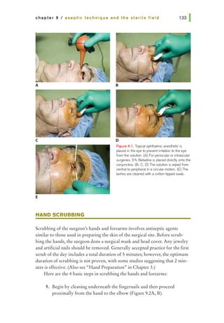 chapter 9 I aseptic technique and the sterile field
A
c
E
8
D
Figure 9.1. Topical ophthalmic anesthetic is
placed in tile eye to prevent irritation to the eye
from tile solution. (A) For periocular or intraoctJiar
surgeries, 5% Be1adine is placed direc1iy onto tile
conjunctiva. (B, C, D) The solution is wiped from
central to peripheral in a circular motion. (E) The
lashes are deaned with a cotton-tipped swab.
HAND SCRUBBING
Scrubbing of the surgeon's hands and forearms involves antiseptic agents
similar to those used in preparing the skin of the surgical site. Before scrub-
bing the hands, the surgeon dons a surgical mask and head cover. Any jewelry
and artificial nails should be removed. Generally accepted practice for the first
scrub of the day includes a total duration of 5 minutes; however, the optimum
duration of scrubbing is not proven, with some studies suggesting that 2 min-
utes is effective. (Also see "'Hand Preparation"' in Chapter 3.)
Here are the 4 basic steps in scrubbing the hands and forearms:
1. Begin by cleaning underneath the fingernails and then proceed
proximally from the hand to the elbow (Figure 9.2A, B).
 