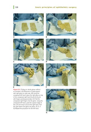 basic pri nci pies of ophthalmic surgery
A
c
E
Figure 9.4. Putting on sterile gloves without
an assistant. (A) Placement of sterile gloves
with right glove on right side. (B) Using the
unexposed left hand, place the right glove on top
of the unexposed right hand thumb-to-thumb
with fingers pointing proximally. (C) Fold the
unexposed right fingers into the glove. Using the
unexposed left hand, grab the superior edge of
the cuff and wrap it around the right hand. Pull
the right sleeve and glove into place. (D, E, F,
G) Repeat the procedure forthe left hand.
8
D
F
G
 