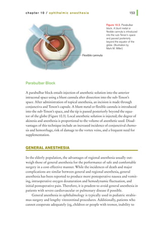 chapter 10 I ophthalmic anesthesia
Parabulbar Block
Figure 10.3. Parabulbar
block. A blunt metal or
flexible cannula is introduced
into the sub-Tenon's space
and passed posteriorly
beyond the equator af the
globe. (Illustration by
Mark M. Miller)
A parabulbar block entails injection ofanesthetic solution into the anterior
intraconal space using a blunt cannula after dissection into the sub-Tenon•s
space. Mter administration of topical anesthesia, an incision is made through
conjunctiva and Tenon's capsule. A blunt metal or flexible cannula is introduced
into the sub-Tenon's space, and the tip is passed posteriorly beyond the equa-
tor ofthe globe (Figure 10.3). Local anesthetic solution is injected; the degree of
akinesia and anesthesiais proportional to the volume ofanesthetic used. Disad-
vantages of this technique include an increased incidence ofconjunctival chemo-
sis and hemorrhage, risk of damage to the vortex veins, and a frequent need for
supplementation.
GENERAL ANESTHESIA
In the elderly population, the advantages of regional anesthesia usually out-
weigh those of general anesthesia for the performance of safe and comfortable
surgery in a cost-effective manner. While the incidences of death and major
complications are similar between general and regional anesthesia, general
anesthesia has been reported to produce more postoperative nausea and vomit-
ing, intraoperative oxygen desaturation and hemodynamic fluctuation, and
initial postoperative pain. Therefore, it is prudent to avoid general anesthesia in
patients with severe cardiovascular or pulmonary disease if possible.
General anesthesia in ophthalmology is typically used in pediatric strabis-
mus surgery and lengthy vitreoretinal procedures. Additionally, patients who
cannot cooperate adequately (eg, children or people with tremor, inability to
 