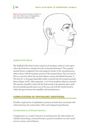basic pri nci pies of ophthalmic surgery
Figure 10.4. Facial nerve blocks. (A) Van Unt
block. (B). O'Brien block. (C) Nadbath-EIIis
block. Ollustrution by Mark M. Miller)
Nadbath-EIIis Block
The Nadbath-Ellis block involves injection of anesthetic solution in the region
where the facial nerve emerges from the stylomastoid foramen. The tympano-
mastoid fissure is palpated at the anterosuperior border ofthe mastoid process,
where it fuses with the tympanic portion ofthe temporal bone. The area may be
felt as a convexity below the external auditory meatus and behind the pinna. A
5/8-inch, 25- or 26-gauge disposable needle is inserted into the tympanomastoid
fissure (Figure 10.4C). After aspiration, 1to 2 ml ofanesthetic solution is injected.
The injection should be made with the head turned to the opposite side to pull
the sternocleidomastoid muscle out ofthe area, and with the mouth closed to
widen the space between the mandible and mastoid process.
COMPLICATIONS OF OPHTHALMIC ANESTHESIA
Possible complications of ophthalmic anesthesia include those associated with
orbital injection, the oculocardiac reflex, and malignant hyperthermia.
Complications of Orbital Injection
Complications as a result of injection of anesthesia into the orbit include ret-
robulbar hemorrhage, scleral perforation, spread of anesthetic into the central
nervous system, and strabismus.
 