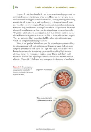 basic pri nci pies of ophthalmic surgery
In general, cohesive viscoelastics are better at maintaining space and are
more easily removed at the end of surgery. However, they are also more
easily removed during phacoemulsification itself, thereby possibly jeopardizing
endothelial cell protection in prolonged surgery or in eyes with small ante-
rior chambers (as in hyperopia). Dispersive viscoelastics are better at coating
tissue and may provide more prolonged endothelial cell protection. However,
they are less easily removed than cohesive viscoelastics, because they tend to
"fragment" upon removal. Consequently, they may be more likely to induce
elevated intraocular pressure (IOP) in the first 24 hours after cataract surgery.
They are also more likely to produce bubbles when injected into the eye,
which can compromise the surgeon's view.
There is no "perfect, viscoelastic, and the beginning surgeon should try
to gain experience with both cohesive and dispersive types. Indeed, some
surgeons prefer to use both types for "high-risk., eyes, such as those with
borderline endothelial functioning, dense nuclei requiring high amounts
of phaco energy for removal, or weak zonules. The so-called soft shell
technique involves first injecting a dispersive viscoelastic into the anterior
chamber (Figure 11.1), followed by a more posterior injection of a cohesive
Figure 11.1. Ring of dispersive
viscoelastic pushed up against
endothelium by injection of
cohesive viscoelastic. (Illustration
by Marl< M. Miller)
Dispersive viscoelastic
ophthalmologyebooks.com
 