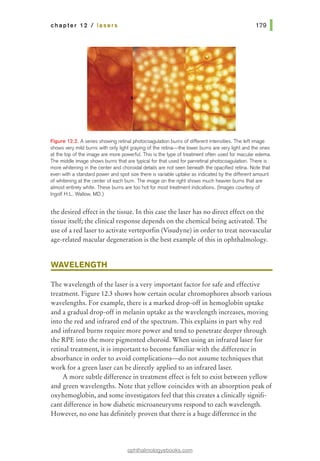 chapter 12 I lasers
Figure 12.2. A series showing retinal photocoagulation bums of different intensities. The left image
shows very mild burns with only light graying of the retina-the lower bums are very light and the ones
at the top of the image are more powerful. This is the type of treatment often used for macular edema.
The middle image shows bums that are typical for that used for panretinal photocoagulation. There is
more whitening in the center and choroidal details are not seen beneath the opacified retina. Note that
even with a standard power and spot size there is variable uptake as indicated by the different amount
of whitening at the center of each bum. The image on the right shows much heavier bums that are
almost entirely white. These bums are too hot for most treatment indications. (Images courtesy of
lngolf H.L. Wallow, MD.)
the desired effect in the tissue. In this case the laser has no direct effect on the
tissue itself; the clinical response depends on the chemical being activated. The
use of a red laser to activate verteporfin (Visudyne) in order to treat neovascular
age-related macular degeneration is the best example ofthis in ophthalmology.
WAVELENGTH
The wavelength of the laser is a very important factor for safe and effective
treatment. Figure 12.3 shows how certain ocular chromophores absorb various
wavelengths. For example, there is a marked drop-off in hemoglobin uptake
and a gradual drop-off in melanin uptake as the wavelength increases, moving
into the red and infrared end of the spectrum. This explains in part why red
and infrared burns require more power and tend to penetrate deeper through
the RPE into the more pigmented choroid. When using an infrared laser for
retinal treatment, it is important to become familiar with the difference in
absorbance in order to avoid complications-do not assume techniques that
work for a green laser can be directly applied to an infrared laser.
A more subtle difference in treatment effect is felt to exist between yellow
and green wavelengths. Note that yellow coincides with an absorption peak of
oxyhemoglobin, and some investigators feel that this creates a clinically signifi-
cant difference in how diabetic microaneurysms respond to each wavelength.
However, no one has definitely proven that there is a huge difference in the
ophthalmologyebooks.com
 