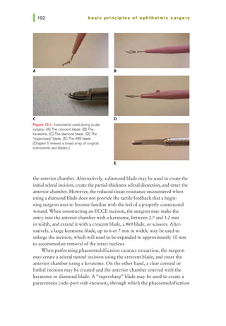 basic pri nci pies of ophthalmic surgery
A
c
F'19ure 13.1. lns1ruments used during ocular
surgery: (A) The crescent blade. (B) The
keratome. (C) The diamond blade. (D) The
•supersharp" blade. (E) The 4#69 blade.
(Chapter 5 reviews a broad array of surgical
instruments and blades.)
8
D
E
the anterior chamber. Alternatively, a diamond blade may be used to create the
initial scleral incision, create the partial-thickness scleral dissection, and enter the
anterior chamber. However, the reduced tissue resistance encountered when
using a diamond blade does not provide the tactile feedback that a begin-
ning surgeon uses to become familiar with the feel of a properly constructed
wound. When constructing an ECCE incision, the surgeon may make the
entry into the anterior chamber with a keratome, between 2.7 and 3.2 mm
in width, and extend it with a crescent blade, a #69 blade, or scissors. Alter-
natively, a large keratome blade, up to 6 or 7 mm in width, may be used to
enlarge the incision, which will need to be expanded to approximately 10 mm
to accommodate removal of the intact nucleus.
When performing phacoemulsification cataract extraction, the surgeon
may create a scleral tunnel incision using the crescent blade, and enter the
anterior chamber using a keratome. On the other hand, a clear corneal or
limbal incision may be created and the anterior chamber entered with the
keratome or diamond blade. A «supersharp"' blade may be used to create a
paracentesis (side-port stab-incision), through which the phacoemulsification
 