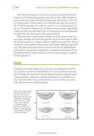 basic pri nci pies of ophthalmic surgery
The clock-hour placement of the wound is determined primarily by the
surgeon's preferred operating position and comfort. Some right-handed sur-
geons choose to sit at the head of the bed and center their incision at the 10 or
11 o'clock position. Others prefer to sit temporally and center the incision at
the 7 to 8 o'clock position for a right eye and the 1 to 2 o'clock position for a
left eye. The patient's anatomy may also dictate incision location. Specifically,
a large nose, deep-set orbit, large brow, corneal opacity, or previous glaucoma
procedure may alter the location of the cataract incision.
While most clear corneal cataract incisions are nearly astigmatically neu-
tral, a larger incision, such as an extracapsular cataract incision, tends to affect
the corneal curvature in a manner similar to a limbal relaxing incision. The cor-
nea flattens in the meridian of the incision and, through coupling, steepens 90°
away. Therefore, the location of the cataract incision may be adjusted based
on the patienes preoperative astigmatism, or astigmatic keratectomy (or toric
IOL placement) may be performed at the time of cataract surgery to address
corneal astigmatism.
SHAPE
Possible incision shapes include linear, curvilinear (circumferential to the lim-
bus), and frown or chevron-shaped (Figure 13.3). As is true for incision loca-
tion and length, the shape of the incision affects the induced astigmatic effect,
with postoperative astigmatism typically minimized by wounds that curve
away from the limbus. Clear corneal incisions are linear as they are created
with a planar keratome or diamond blade.
Figure 13.3. Incision shapes.
(~ Curvilinear. (B) Straight.
(C) Frown. (D) Chevron.
(Reproduced with permission.
From Masket S. Cataract
incision and closure. Focal
Points: Clinical Modules
for Ophthalmologists.
San Francisco: American
Academy of Ophthalmology;
1995, module 3. lllus1ration
by Christine Gralapp.)
B
ophthalmologyebooks.com
 