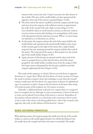 chapter 14 I suturing and knot tying
sutures in the cornea, but only 1loop is necessary for skin closure in
the eyelids.) The jaws of the needle holder are then opened and the
opposite, short end of the suture is grasped (Figure 14.1D).
3. The short end of the suture is pulled toward the surgeon and the long
end away from the surgeon, with sufficient tension to approximate
the walls of the wound with only slight eversion (Figure 14.1E).
Care should be taken to avoid excessive tension, as this may result in
excessive tissue eversion after healing or in strangulation of the tissue
with subsequent ischemia and tissue necrosis. When 1 or more loops
are tied down, it is referred to as a throw.
4. At this point, the surgeon releases the end of the suture held by the
needle holder and repositions the closed needle holder in the center
of the wound, again to the right of the suture (for a right-handed
surgeon), but now pointing toward the surgeon and the short end of
the suture. The long end of the suture is then looped over the closed
tips of the needle holder (Figure 14.1F).
5. Again, the jaws of the forceps are opened and the short end of the
suture is grasped; however, this time the short end of the suture
grasped by the needle holder is pulled away from the surgeon while
the longer suture end grasped by the forceps is pulled toward the
surgeon, tightening the knot (Figure 14.1G).
The result of this sequence, in which 2 throws are tied down in opposite
directions, is 1 square knot. When the first throw of a knot consists of 2 loops,
the result is termed a surgeon's knot; this technique is used when the wound
tension would cause the first throw of a square knot to loosen. In ophthalmol-
ogy it is customary to place 3 loops in the first throw of the knot when using
10-0 nylon because of the tendency for 10-0 suture to loosen.
Typically, 1 additional throw is placed over a square knot or a surgeon's
knot to complete the tie, although in some circumstances, 2 knots (4 throws)
or more can be placed if unraveling of the knot is a concern. Regardless of
the number of knots placed, it is critical that each consecutive throw result
in the 2 ends of the suture each being pulled from 1 side of the wound to the
opposite side; only in this fashion will the knot be "square."
BASIC SUTURING PRINCIPLES
When placing sutures, the surgeon grasps the needle near the tip of the needle
holder, at a point on the needle approximately two-thirds the distance from
the needle tip to the swaged end (where the suture is attached). The needle
 